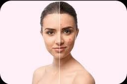 MakeO Skin Care Clinic Andheri West.